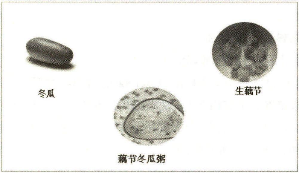 石淋(尿路結(jié)石癥)